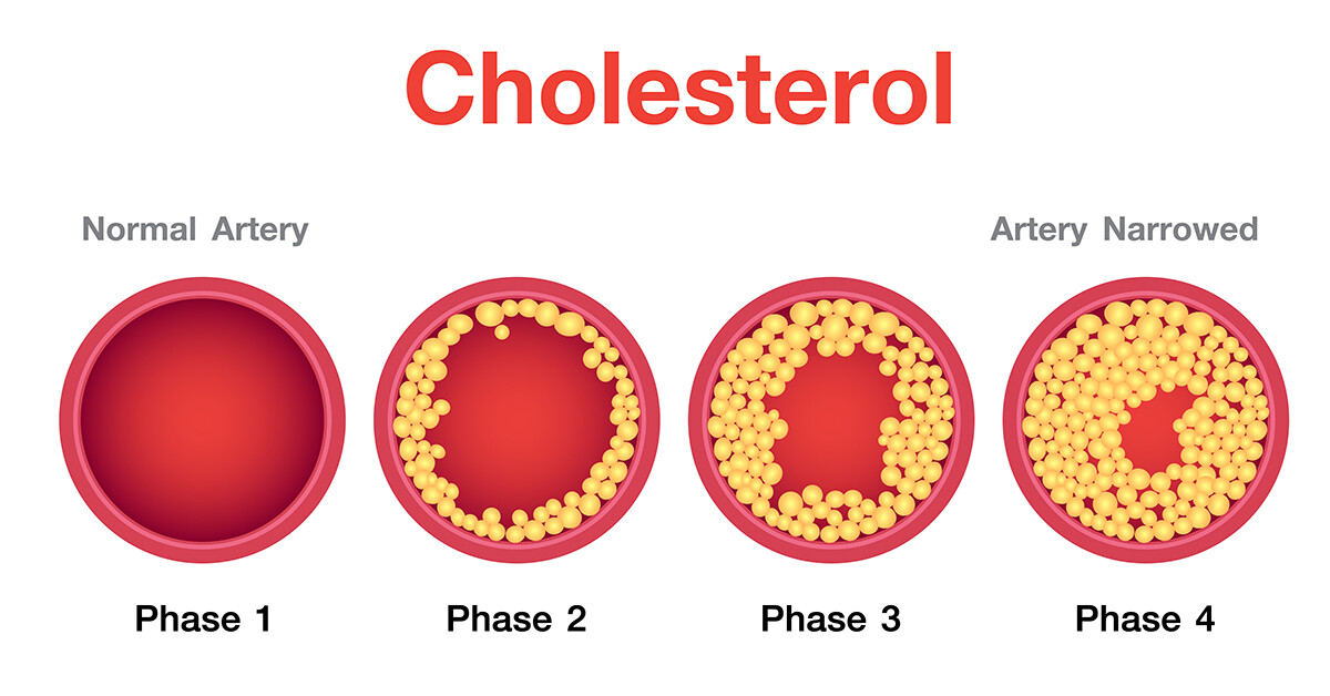 Wat is cholesterol